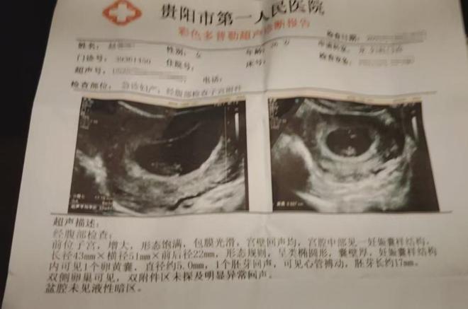 担忧:害怕美味成“隐患”麻将胡了火锅底料过期孕妇(图4) 担忧:害怕美味成“隐患”麻将胡了火锅底料过期孕妇(图4)